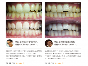 スクリーンショット-2017-06-19-18.17.53